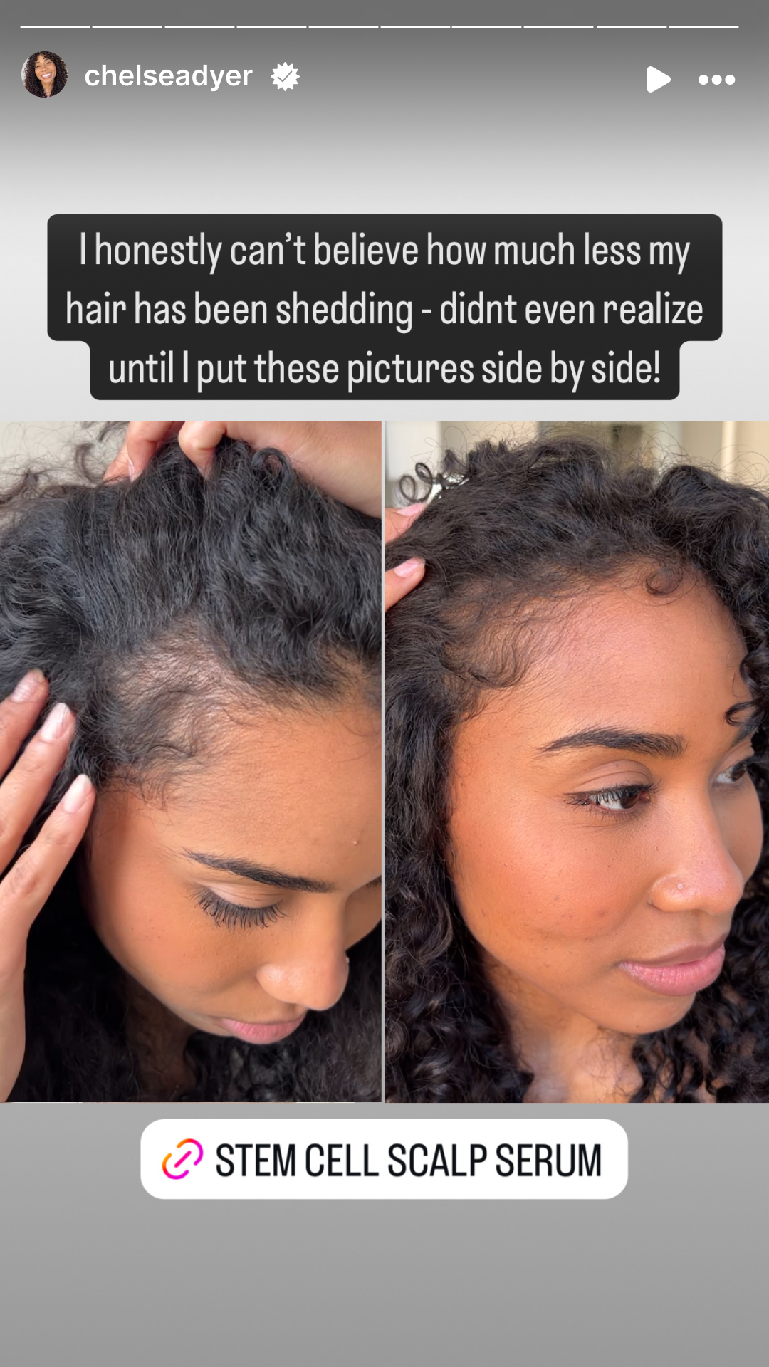 Fuller Hair Starts With This Kit