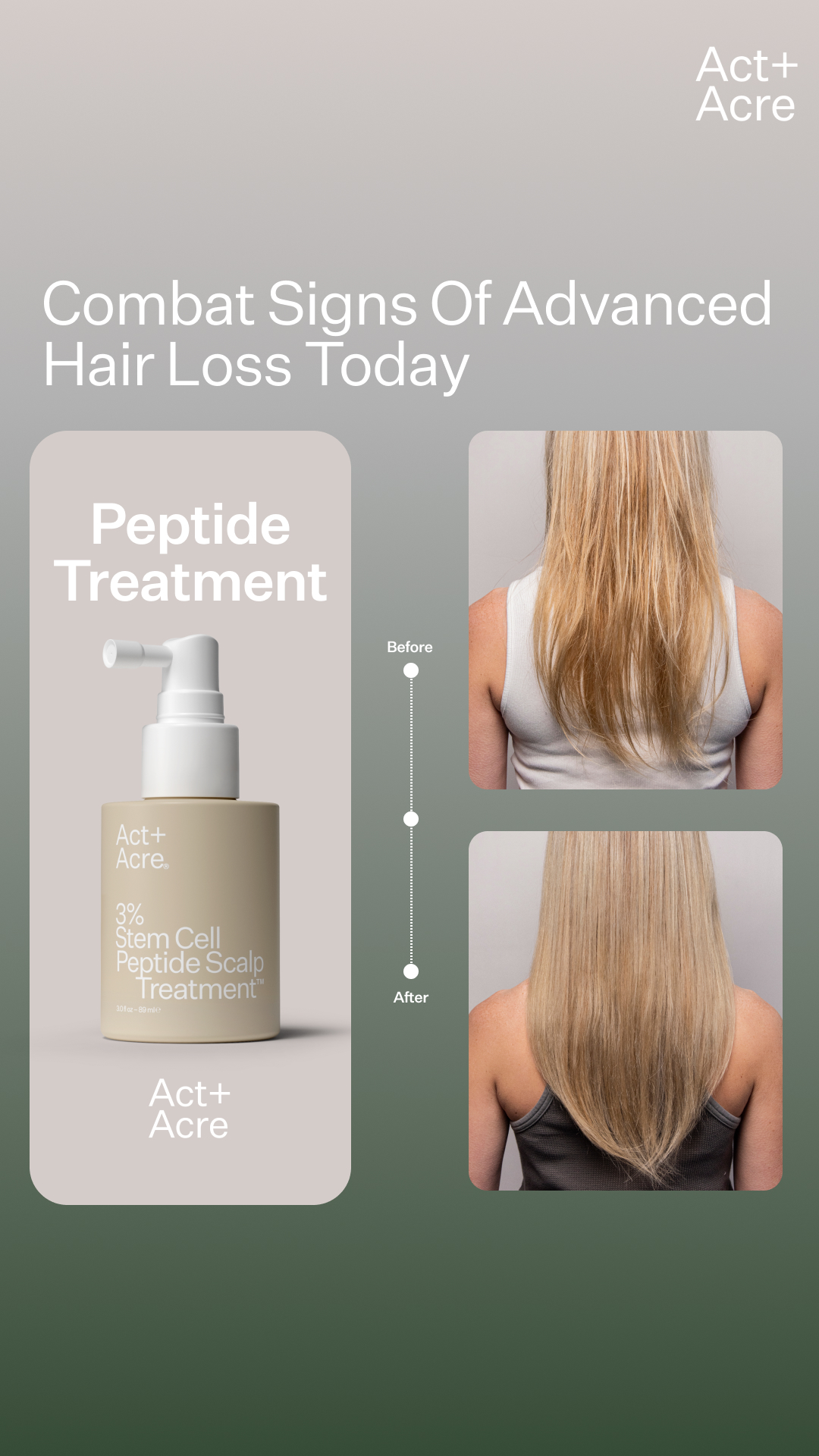 Your Fuller Hair Starter Kit.