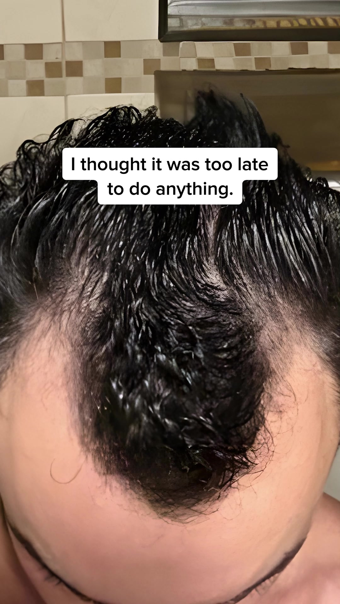 A New Era for Hair Treatments